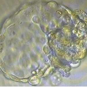 fully hatched blastocyst