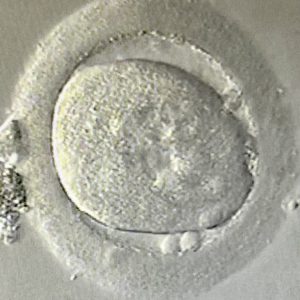 day 1 embryo